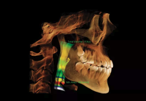 Reconstrucción 3D Cone Beam dental